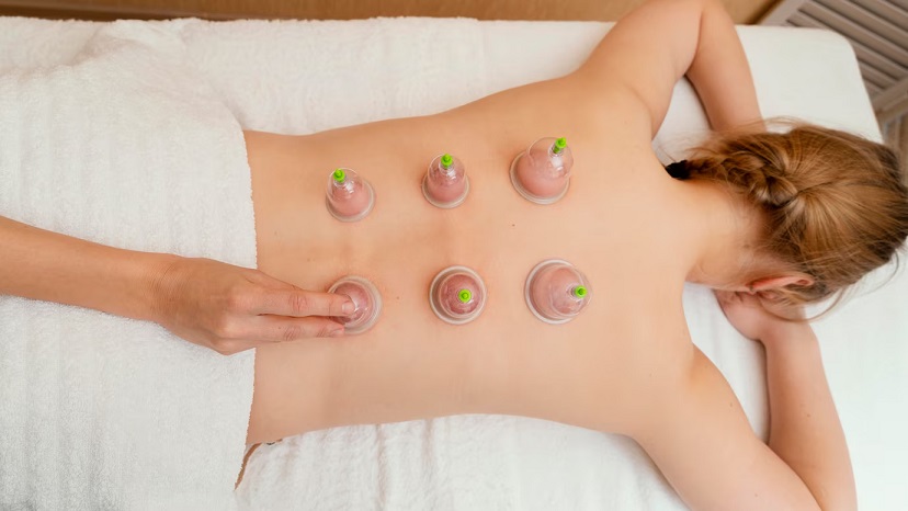 Cupping Therapy – Effortless Coping Up Mechanism from Pain 