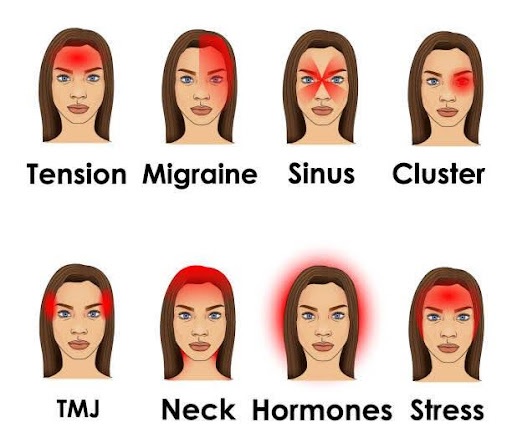 Understanding the Different Types of Headaches and How to Manage Them